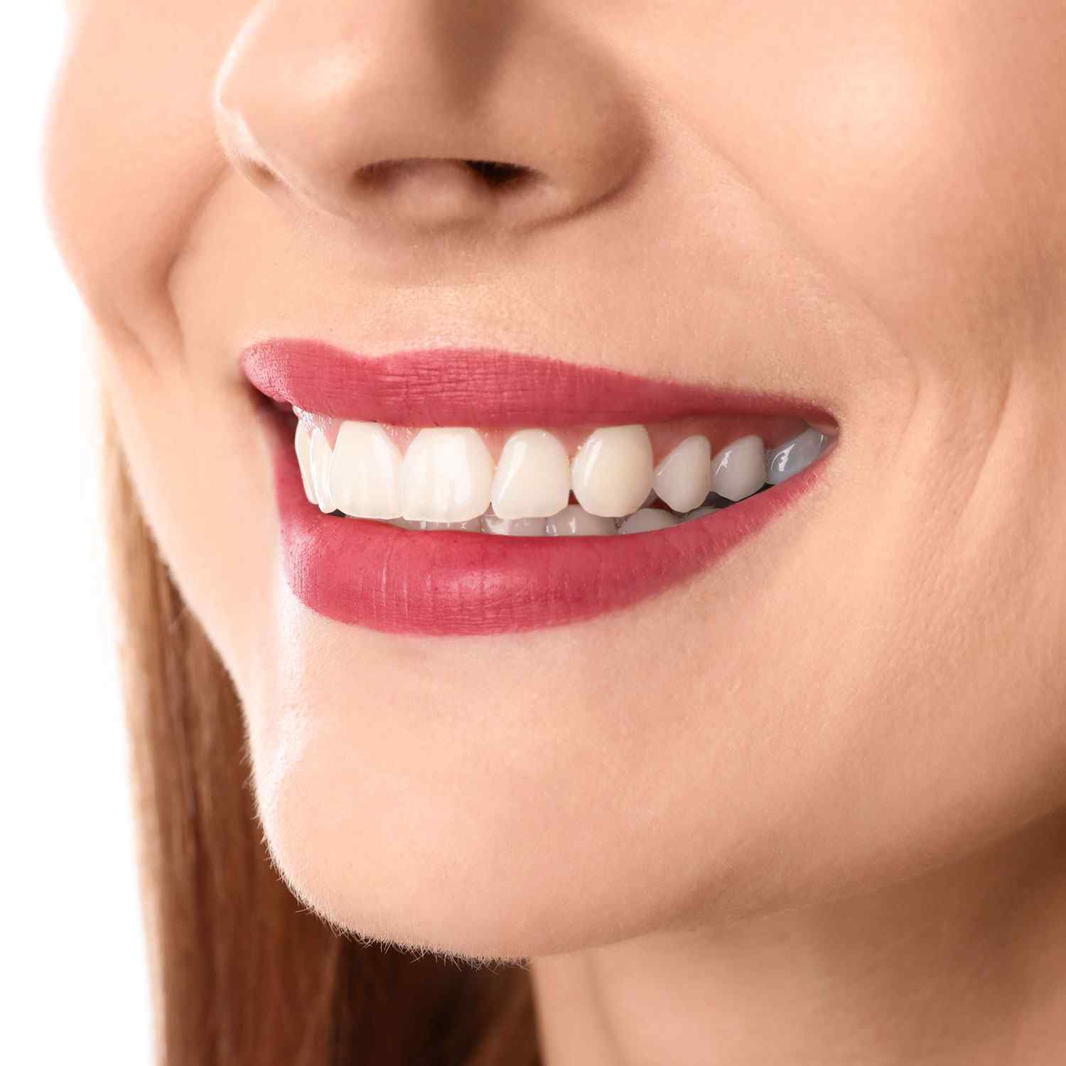 https://site.fenixora.com/wp-content/uploads/2020/03/service_whitening.jpg